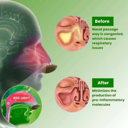 SHALLSHOPS™ - Comfortable Nasal Solution